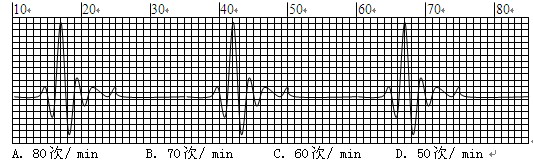 5 m/min,ͼзֽÿС1 mm ,˵Ϊ