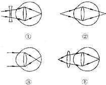 图(选填"甲"或"乙")表示近视眼成像示意图.