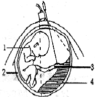 为有效控制遗传病发生率,用PTC穿刺针在超声